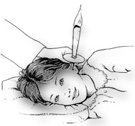 Otosan Natural Ear Drops Instructions